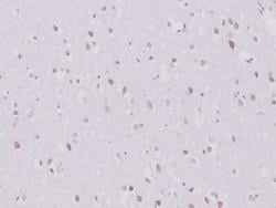 RBFOX3/NeuN Rabbit anti-Human, Clone: NeuN/6694R, Novus Biologicals 100 &mu;g | Buy Online | Novus Biologicals | Fisher Scientific